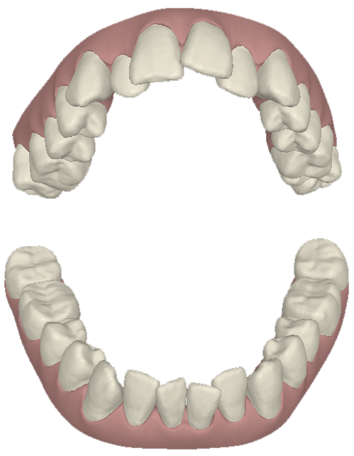 Best Braces & Orthodontics only at www.topdentistdelhi.com